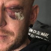 Gewalt gegen Homosexuelle nimmt zu