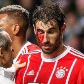 Ohne Rücksicht auf Verluste