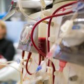 Die Nieren leiden lange Zeit nur stumm