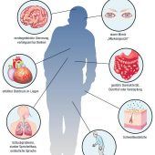 Parkinson: „Viele fühlen sich abgeschrieben“