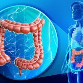 Bessere Chancen bei Darmkrebs