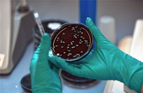 Diese Bakterienkultur besteht aus Legionellen. Durch sie ausgelöste Infektionskrankheiten registrierte das Gesundheitsamt heuer bereits 16-mal.Foto dpa