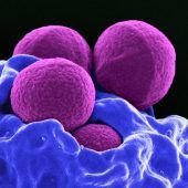 Die häufigsten multiresistenten Erreger