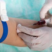 Deutscher Lebertag am 20. November: „Ist Ihre Leber gesund?“