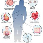 Eine Art Impfstoff gegen Parkinson