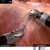 Moderne Technik im OP: Wo Roboter heute schon das Skalpell führen