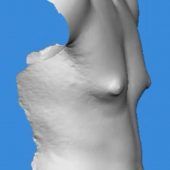 Wenn Männern Brüste wachsen