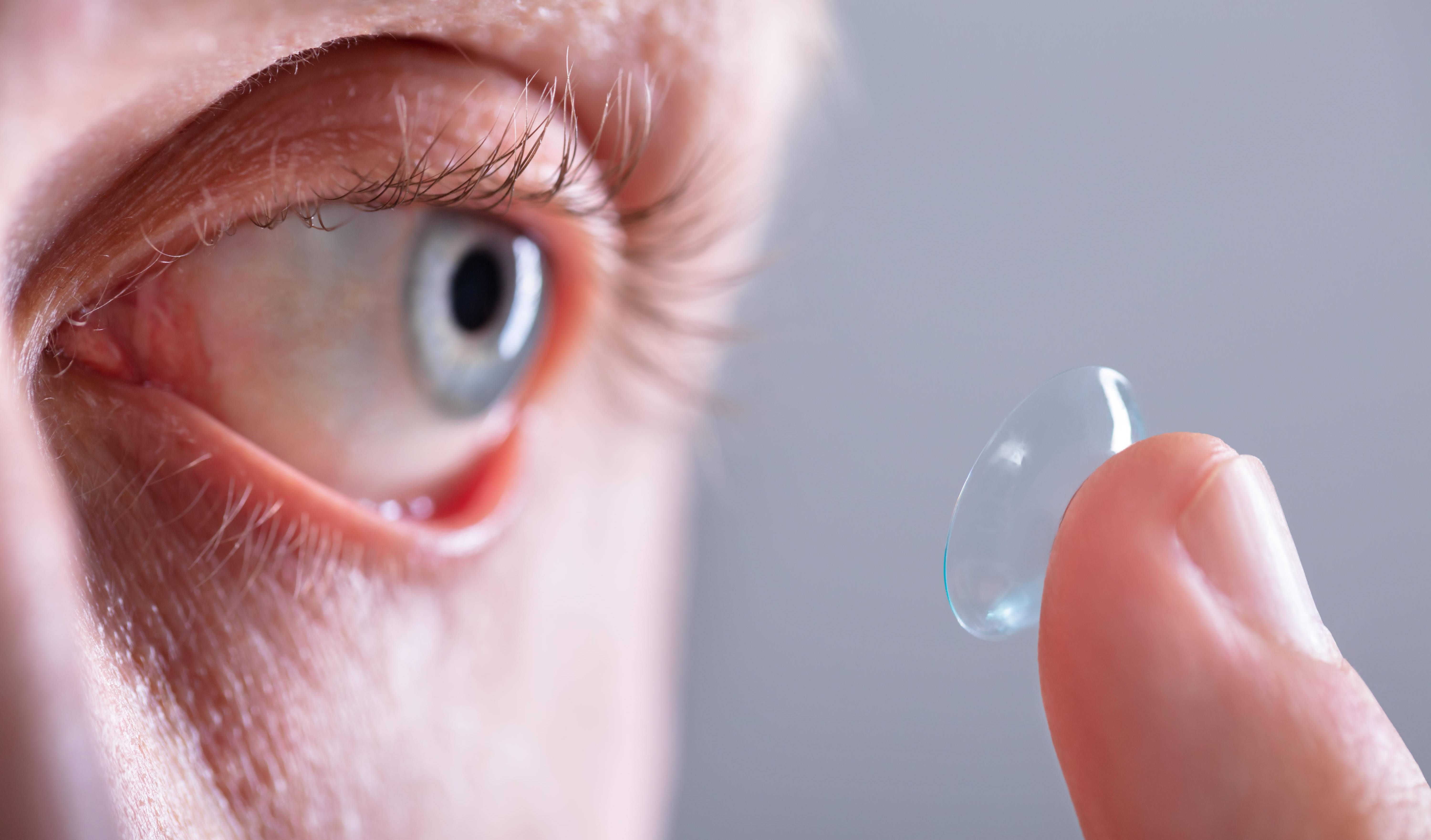 OVB Heimatzeitungen | Linse statt Brille? Informationen und Tipps für Kontaktlinsenträger