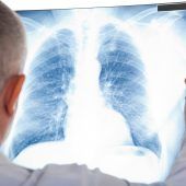 Endlich wieder frei atmen!