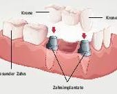 Beratung und Infotelefon: Praktische Tipps für Patienten