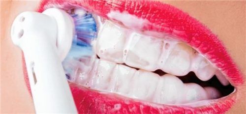 Entzündungs-Screening und Professionelle Zahnreinigung sind entscheidend für den Weg zur Gesundheit. Foto Fotolia