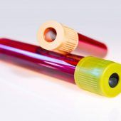 10 Nährstoffe im Blut