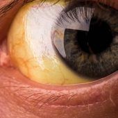 Verständliche Infos für Patienten: Hier bekommen Sie Hilfe!