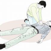 Prüfen, Rufen, Drücken: Erste Hilfe bei einem Herzstillstand