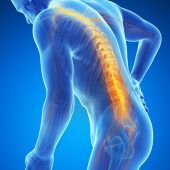 Hightech für den kranken Rücken