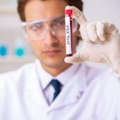 Prostatakrebs: PSA-Test ja oder nein?