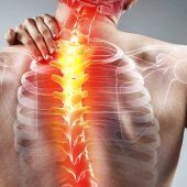 5 Nackenverspannung & Rückenleiden