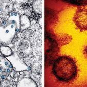 Corona-Epidemie: Was Sie jetzt wissen müssen