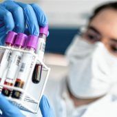 Verwirrung um Corona-Tests