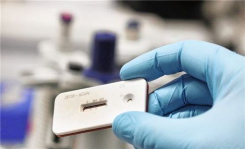 Wie viele Menschen sind infiziert, wie viele genesen? Schnelltests geben Hoffnung, diese dringend benötigten Zahlen liefern zu können. Foto dpa