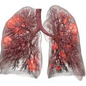 Schonendere Beatmung dank Computertechnik?