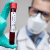 Was Antikörper-Tests wirklich können