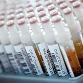 Ärzte setzen auf Corona-Tests