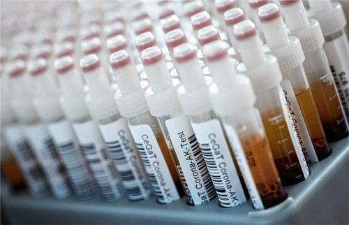 Das Interesse an den Corona-Tests für alle steigt in der Region Rosenheim.Foto dpa