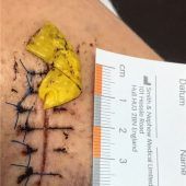 Hundebisse: „Es tut mir schrecklich leid“