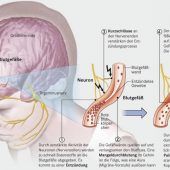 Das Hämmern im Kopf