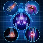 Hartkäse und Heimtrampolin: Was den Knochen guttut – und was nicht