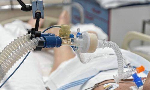 Ein Beatmungsgerät für Corona-Patienten ist ohne Kunststoff undenkbar. (Symbolfoto)
