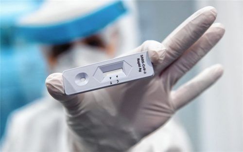 Fingerzeig für effiziente Seuchenbekämpfung? Mehr Antigen-Tests fordert der Rosenheimer Arzt Dr. Stein.Foto  dpa