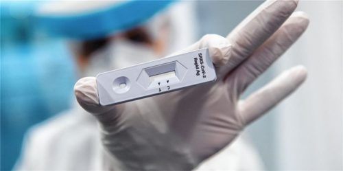 Kein Garant für die Einreise: Auch ein absolvierter Corona-Test soll in Österreich künftig nicht mehr von der Quarantänepflicht befreien. Foto dpa