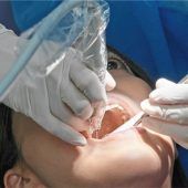 Wurzelb ehandlung: Wenn Karies tiefer geht