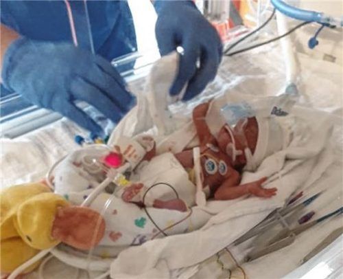 Das erste Foto von Elli-Lou am Tag ihrer Geburt.Foto Privat