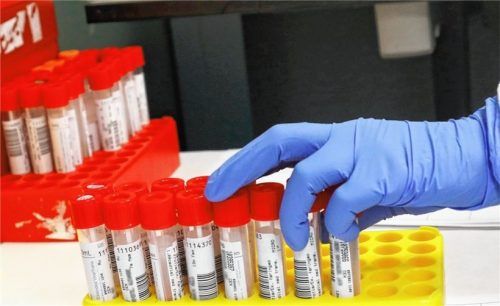 Viren-Fahnder: Mit PCR-Tests kommen Labors der Omikron-Variante auf die Spur. Foto dpa