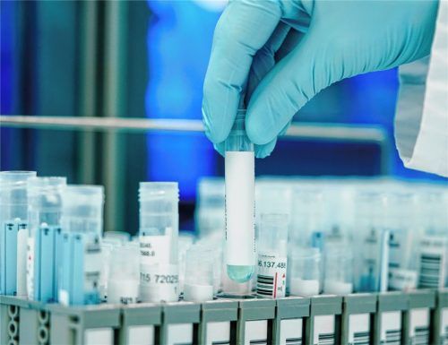 Ein Labor-Mitarbeiter hält ein PCR-Teströhrchen in den Händen. Foto dpa