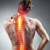 Endlich schmerzfrei ohne Rücken-Operation