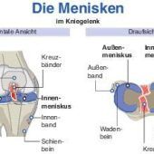 Der Krisenplan fürs Knie