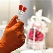 Studien-Ergebnisse werden vorgestellt