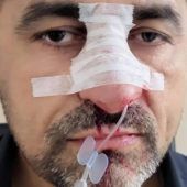 Haftstrafe nach rassistischer Attacke