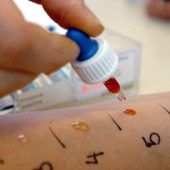 Testsieger für lokale Behandlung Die vorbeugende Behandlung Cortison nur kurzfristig anwenden Diese Mittel können Sie Kindern geben