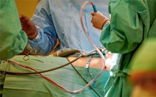 Eingriff im Operationssaal (Symbolfoto): Ein Chirurg muss sich wegen Körperverletzung auch an einem Rosenheimer verantworten. Foto /dpa