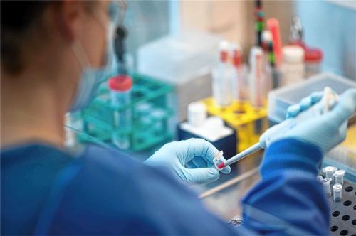 Fakten-Fischer: Labors können aus Abwasserproben nicht nur die Virenlast ableiten, sondern per Sequenzierung auch die Varianten und Mutationen ableiten. Foto dpa