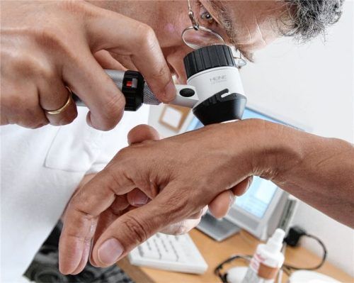 Mit der Lupe gesucht: Auch für die Dienste von Hautärzten muss man sich in der Region Rosenheim lange gedulden. Foto dpa