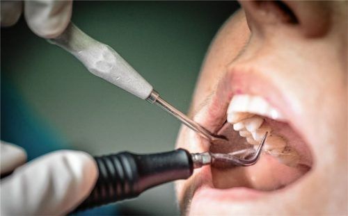 Blick ins Innere: Besonders junge Menschen mit guter Zahnhygiene brauchen nicht unbedingt eine Zahnzusatzversicherung. Foto Frank Rumpenhorst/dpa-tmn