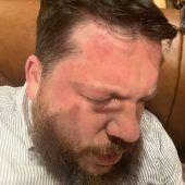 Vertrauter von Nawalny in Litauen attackiert