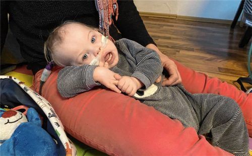 Maksim ist 15 Monate alt, hat einen Herzfehler und leidet zudem an Lungenhochdruck und Trisomie 21. Foto Stiftung AKM Zentrum Südostoberbayern