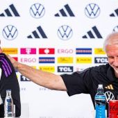 Nagelsmann muss improvisieren